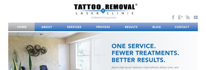 How Well Does Laser Tattoo Removal Work